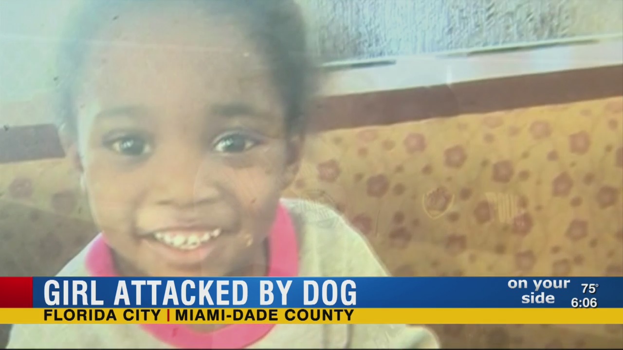 3-year-old Florida girl severely mauled in dog attack